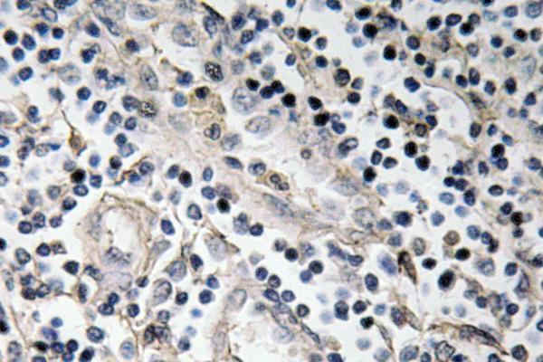 a00858 bmp7 primary antibodies ihc testing 1