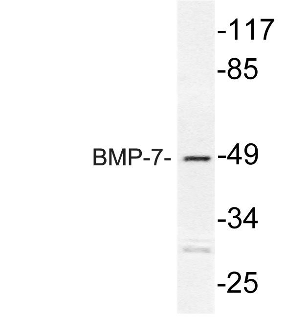 Western blot analysis of lysate from Jurkat cells, using BMP-7 antibody
