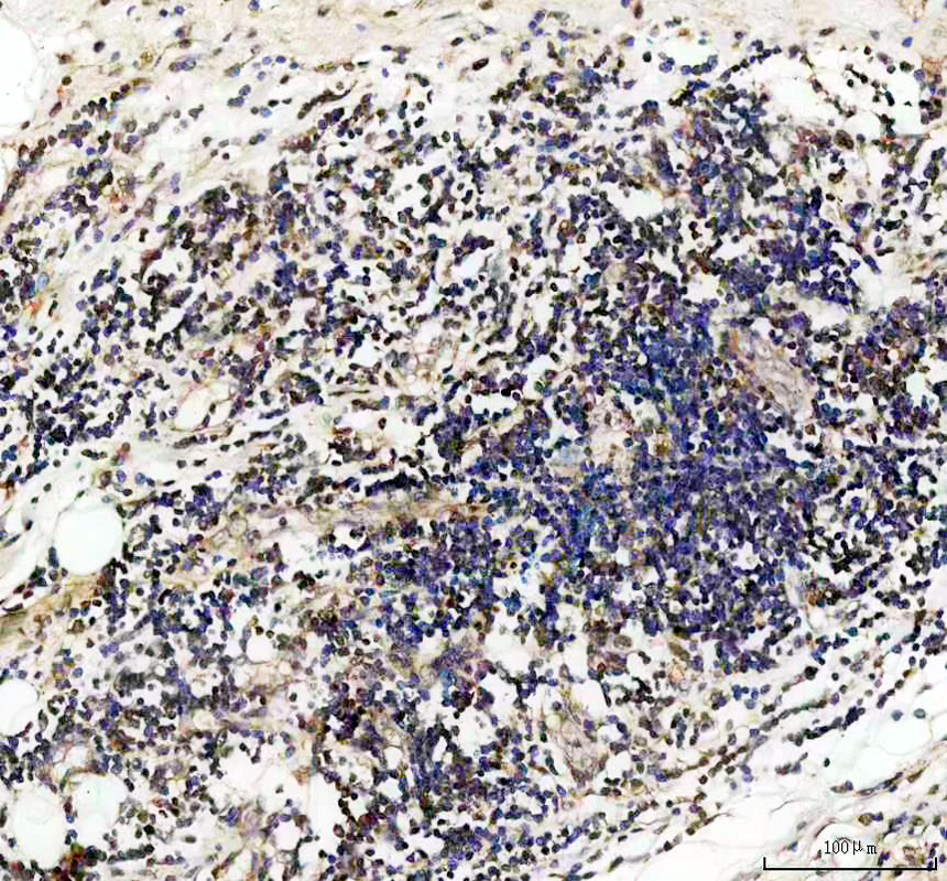 IHC analysis of MST1/STK4 using anti-MST1/STK4 antibody (A00859-2)