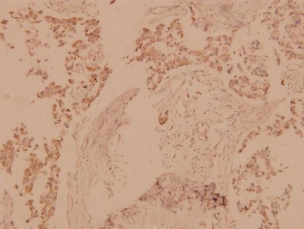 a00859 stk4 primary antiboties ihc testing 2