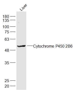 Sample:
Liver (Mouse) Lysate at 40 ug
Primary: Anti-Cytochrome P450 2B6 at 1/1000 dilution