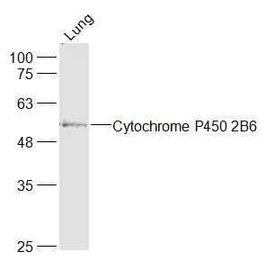 Sample:
Lung (Mouse) Lysate at 40 ug
Primary: Anti-Cytochrome P450 2B6 at 1/1000 dilution