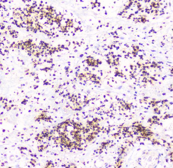 a00863 tnfrsf11b primary antibodies ihc testing 23