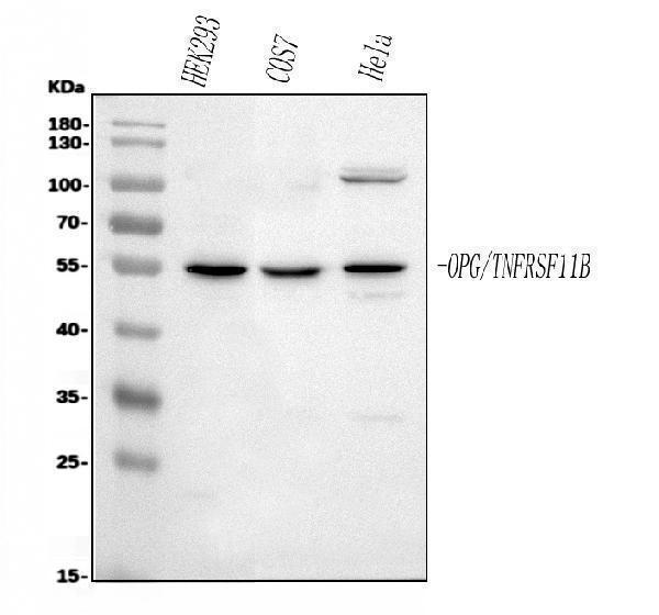  Western blot analysis of TNFRSF11B using anti-TNFRSF11B antibody (A00863)