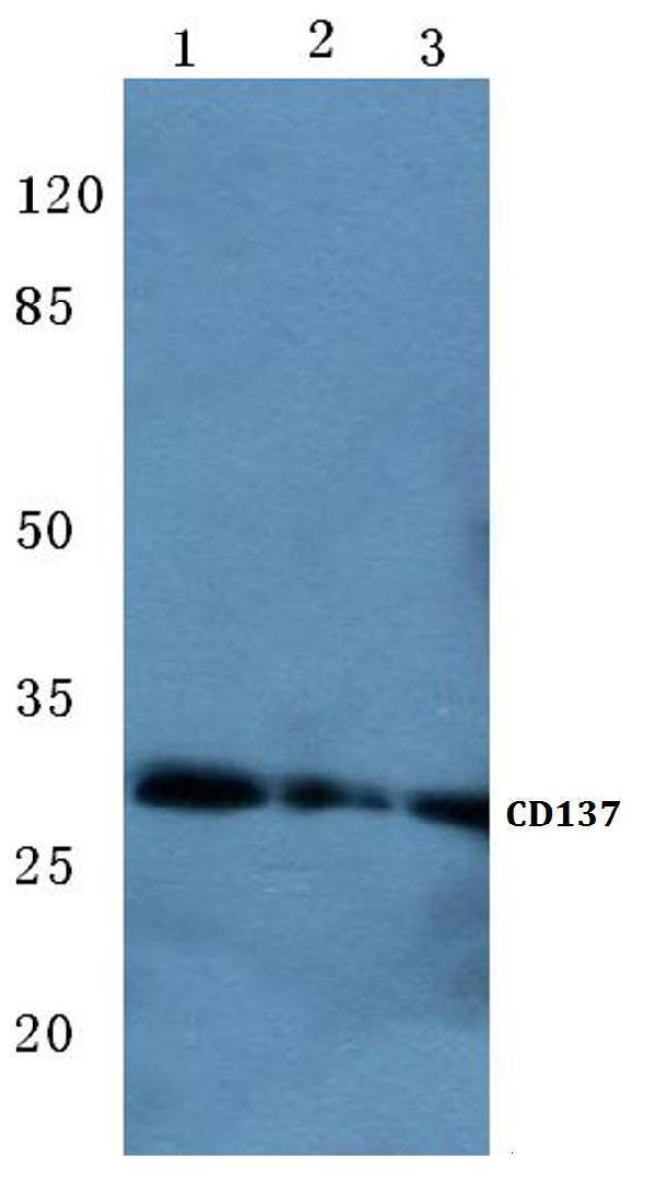 Western blot (WB) analysis of CD137 (K107) polyclonal antibody at 1:500 dilution
Lane1:Hela cell lysate
Lane2:sp2/0 cell lysate
Lane3:H9C2 cell lysate