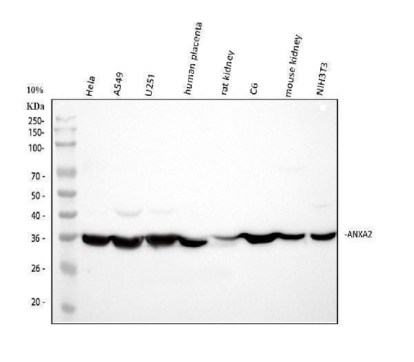  Western blot analysis of Annexin A2/ANXA2 using anti-Annexin A2/ANXA2 antibody (A00868-1)