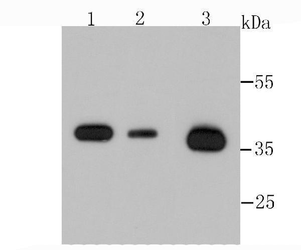 Western blot analysis of Annexin A2 on different cells lysates using anti-Annexin A2 antibody at 1/500 dilution