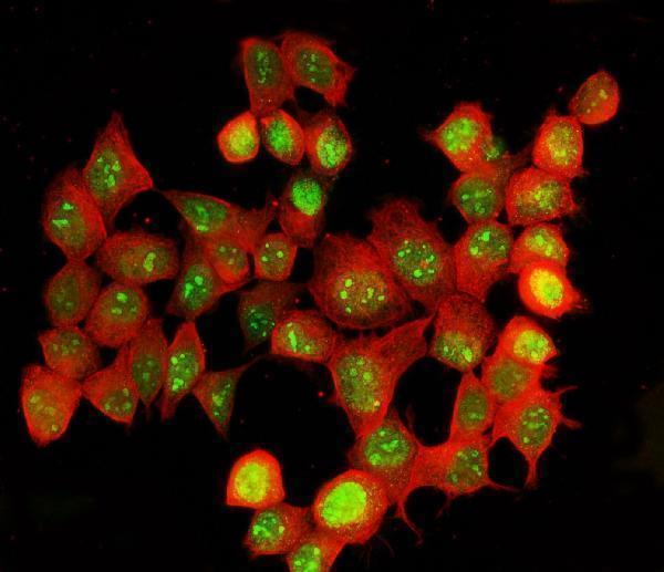 a00869 2 adar primary antibodies if testing 6
