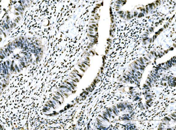 a00869 2 adar primary antibodies ihc testing 5