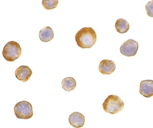 Immunocytochemistry of IKK gamma in HeLa cells with IKK gamma antibody at 5 μg/mL