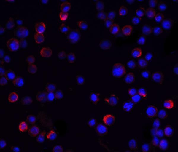 Immunofluorescence of IKK gamma in Hela cells with IKK gamma antibody at 20 μg/mL