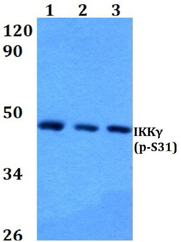 Western blot (WB) analysis of p-IKKγ (S31) polyclonal antibody at 1:500 dilution
Lane1:HEK293T cell lysate treated with TNFa(20ng/ml,15mins)
Lane2:Raw264