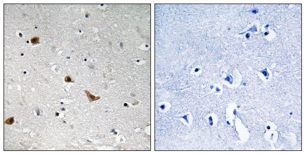 Immunohistochemistry analysis of paraffin-embedded human brain, using IKK-gamma (Phospho-Ser376) Antibody