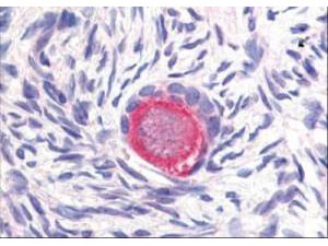 a00875 2 dll4 primary antibodies ihc testing 1_1