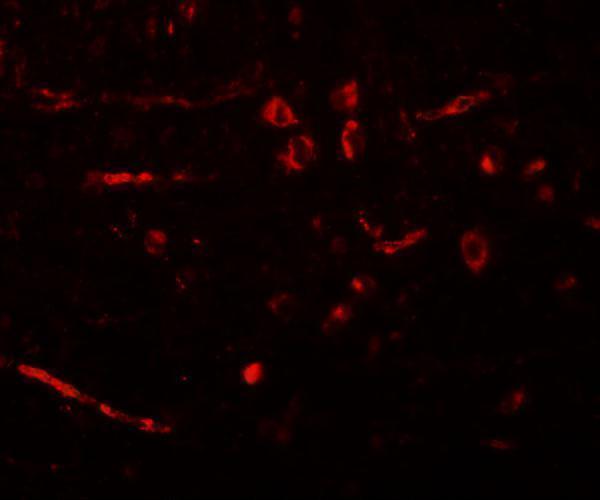 a00877 1 cdx2 primary antibodies if testing 3