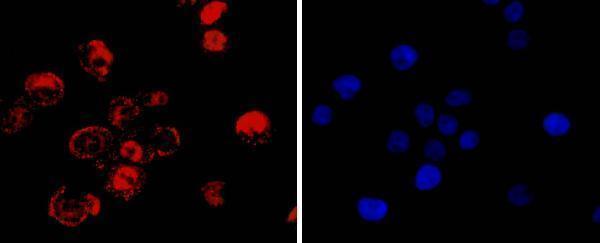 ICC staining CDX2 in LOVO cells (red)