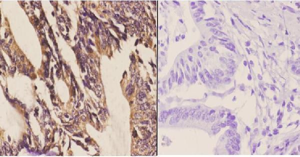 a00878 dyrk1a primary antiboties ihc testing 2