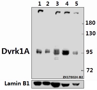 a00878 dyrk1a primary antiboties wb testing 1