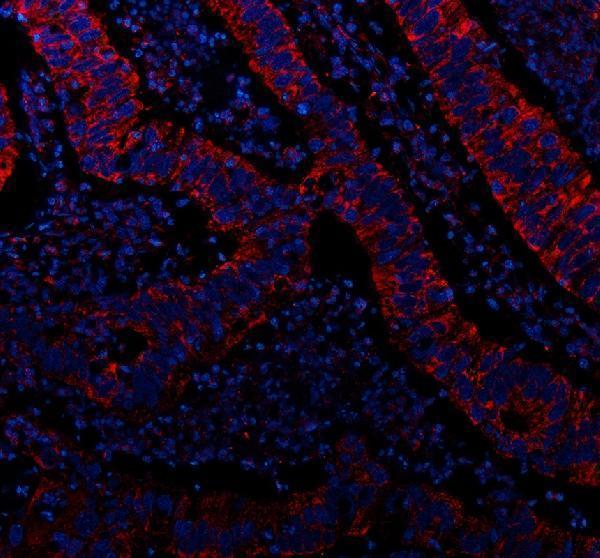 a00880 2 myh9 primary antibodies if testing 2