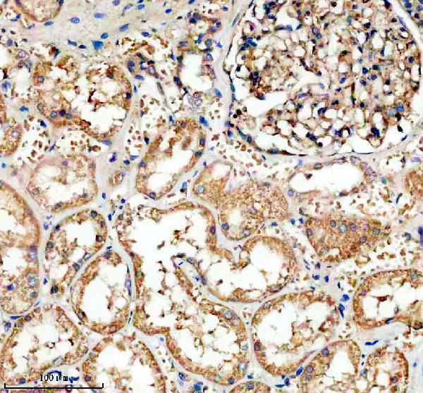 IHC analysis of MYH9 using anti-MYH9 antibody (A00880-2)