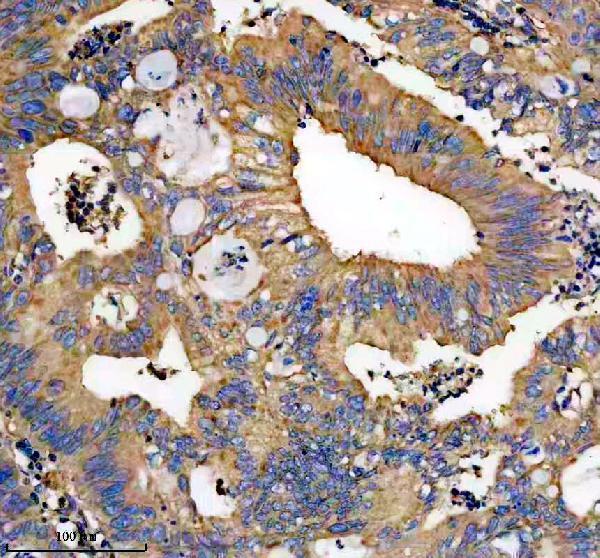 IHC analysis of MYH9 using anti-MYH9 antibody (A00880-2)