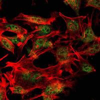 Immunofluorescence analysis of LOVO cells using ESET Monoclonal Antibody (green)