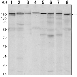 Western Blot analysis using ESET Monoclonal Antibody against MCF-7 (1),T47D (2), HEK293 (3), JURKAT (4), NIH/3T3 (5), F9 (6), RAW246