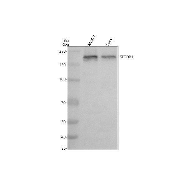 Western blot analysis of SETDB1 using anti-SETDB1 antibody (A00881-3)