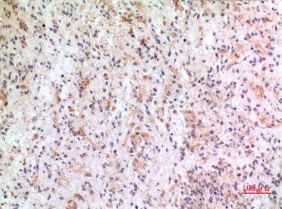 Immunohistochemistry validation of CX3CL1 using Anti-Fractalkine CX3CL1 Antibody (A00882)