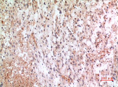 Immunohistochemistry validation of CX3CL1 using Anti-Fractalkine CX3CL1 Antibody (A00882)