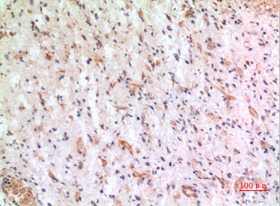 a00882 cx3cl1 primary antibodyes ihc testing 4