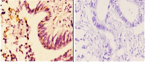 a00883 2 adra2a primary antiboties ihc testing 2