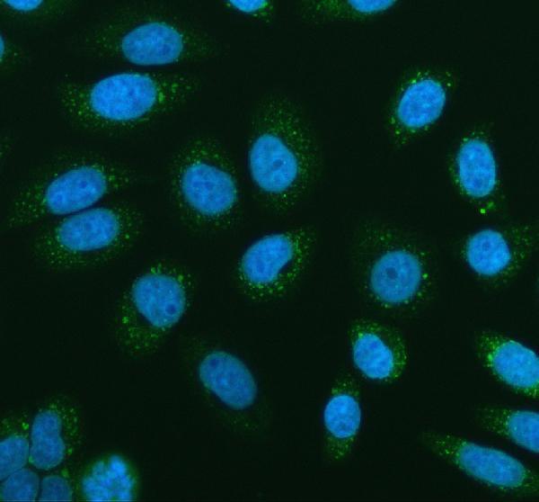 a00884 1 glucokinase primary antibodies if testing 1