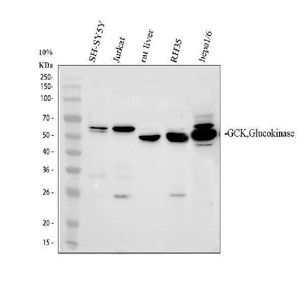 a00884 1 glucokinase primary antibodies wb testing 1