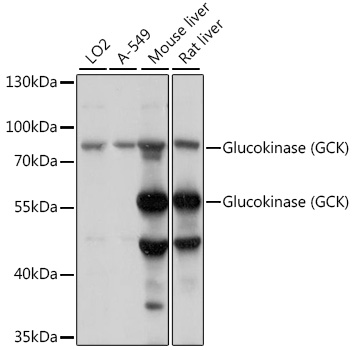 Western blot analysis of extracts of various cell lines, using Glucokinase (Glucokinase (GCK)) antibody at 1:1000 dilution