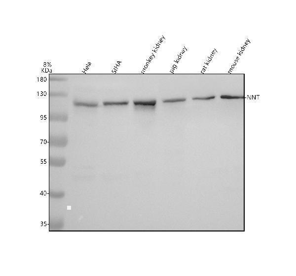  Western blot analysis of NNT using anti-NNT antibody (A00887-3)