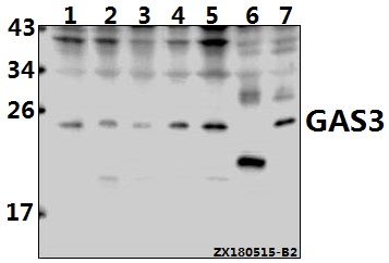 Western blot (WB) analysis of GAS3 (A142) pAb at 1:500 dilution
Lane1:MCF-7 whole cell lysate(40ug)
Lane2:H1792 whole cell lysate(40ug)
Lane3:A2780 whole cell lysate(40ug)
Lane4:HCT116 whole cell lysate(40ug)
Lane5:PC3 whole cell lysate(40ug)
Lane6:PMVEC whole cell lysate(40ug)
Lane7:CT-26 whole cell lysate(40ug)