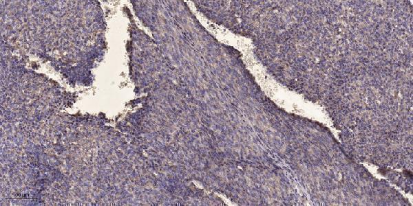 a00891 1 nr5a1 primary antibodies ihc testing 1