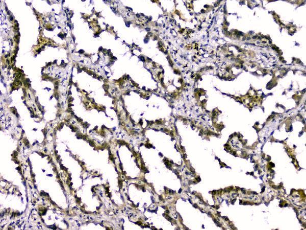  IHC analysis of TGF beta 2 using anti-TGF beta 2 antibody (A00892-1)