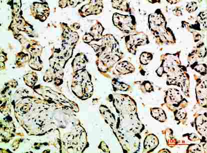 Immunohistochemical analysis of paraffin-embedded human-placenta, antibody was diluted at 1:200
