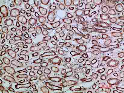 Immunohistochemical analysis of paraffin-embedded human-kidney, antibody was diluted at 1:200