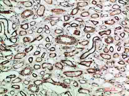 Immunohistochemical analysis of paraffin-embedded human-placenta, antibody was diluted at 1:200