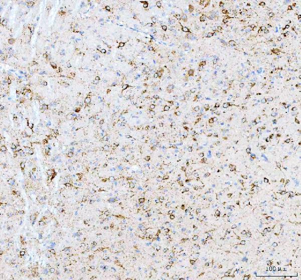 a00894 2 calr primary antibodies ihc testing 11