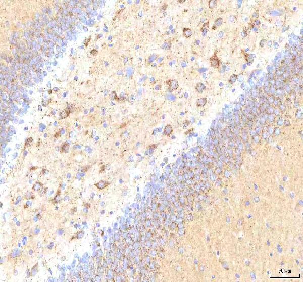 a00894 2 calr primary antibodies ihc testing 12
