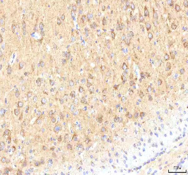 a00894 2 calr primary antibodies ihc testing 13