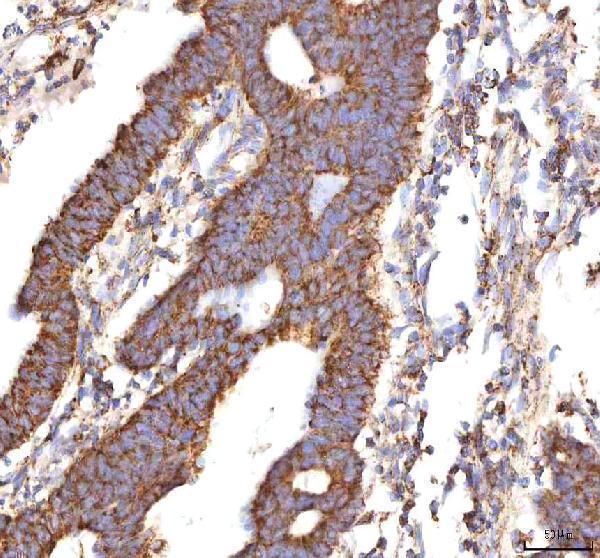  IHC analysis of Calreticulin/CALR using anti-Calreticulin/CALR antibody (A00894-2)
