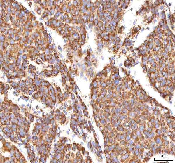 a00894 2 calr primary antibodies ihc testing 5