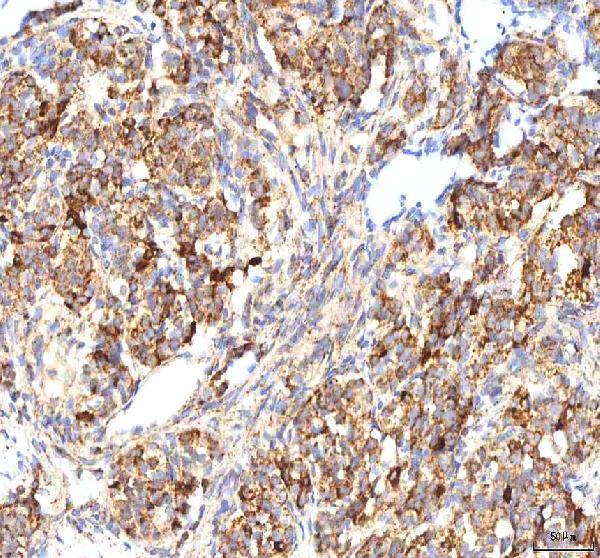 a00894 2 calr primary antibodies ihc testing 6