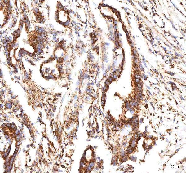 a00894 2 calr primary antibodies ihc testing 7