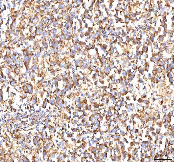 a00894 2 calr primary antibodies ihc testing 8